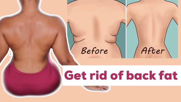 How to get rid of back for fat